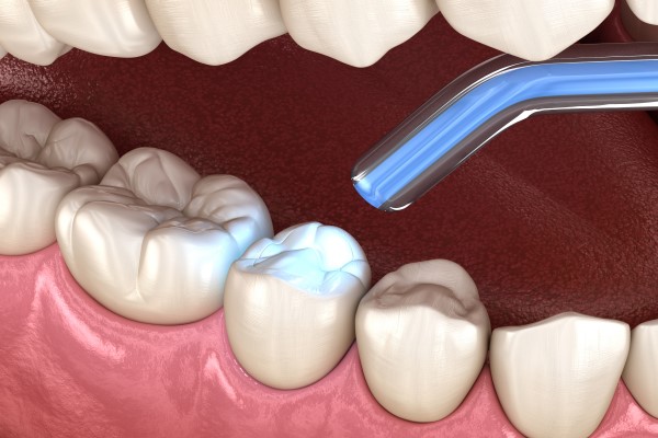 Digital illustration - closeup of teeth being examined
